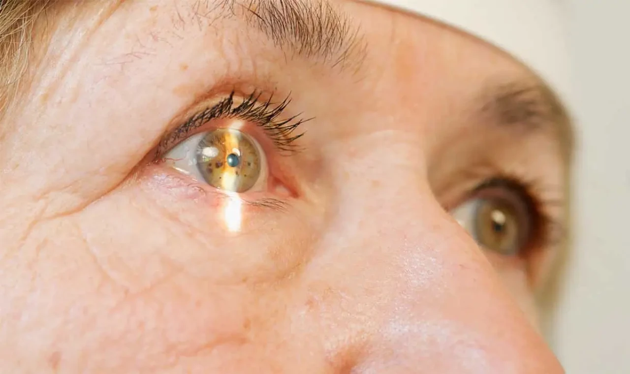 Sinsi ilerliyor kalıcı hasar bırakıyor